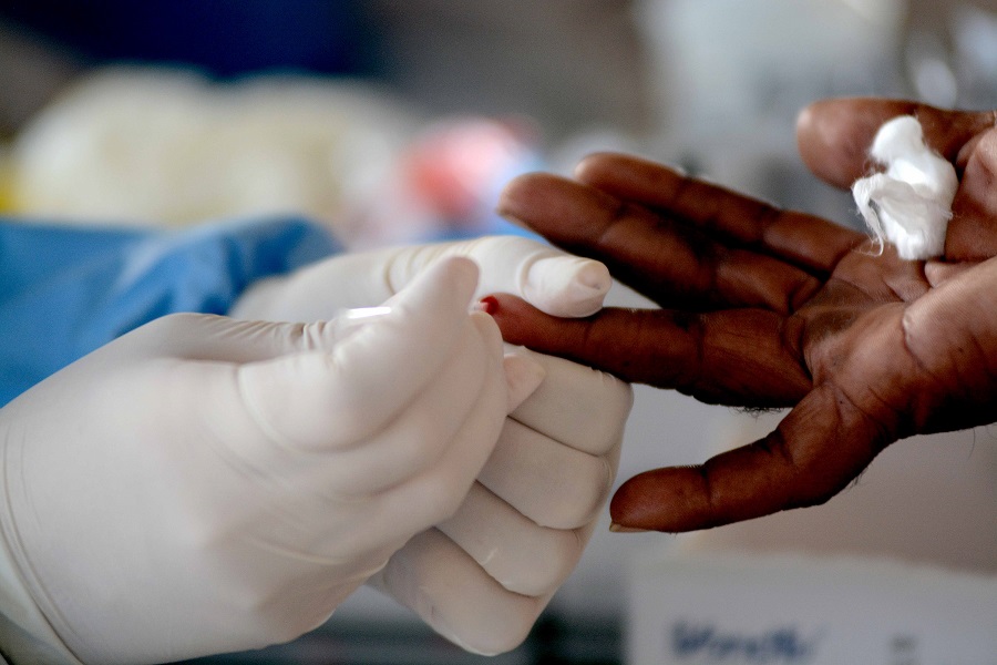 Prefeitura já fez mais de 13 mil testes rápidos em bairros com restrições