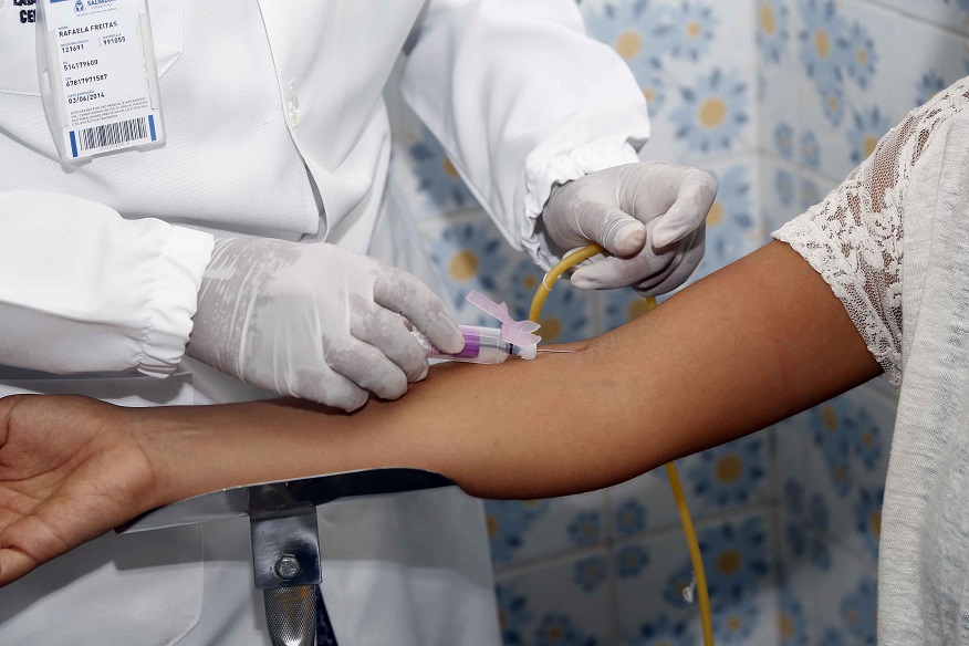 Unidades de saúde disponibilizam testes rápidos para detecção de DSTs