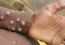 Brasileiro tem 1º caso de varíola dos macacos registrado na Alemanha 
