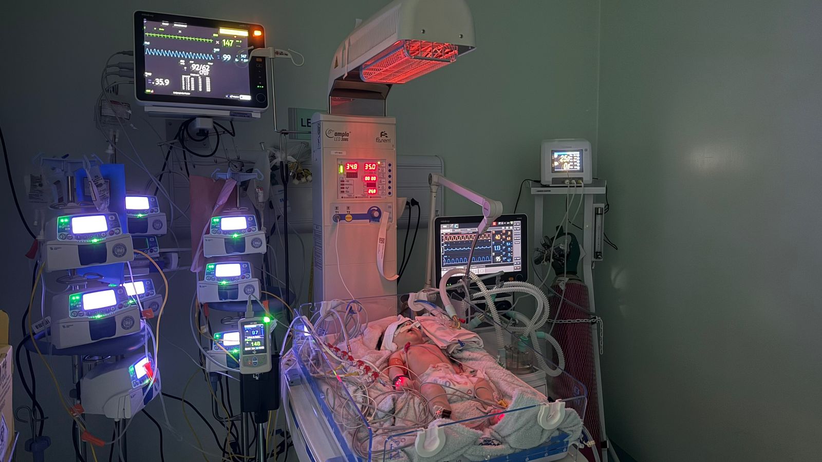 Bebê supera quadro gravíssimo e deixa UTI neonatal sem sequelas em Feira